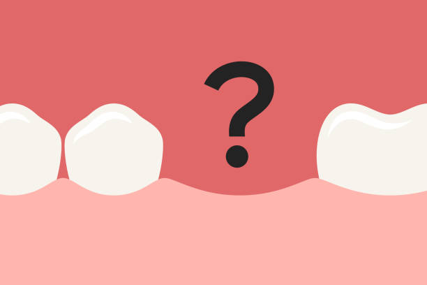 ما  أخطر مضاعفات فقدان الأسنان؟